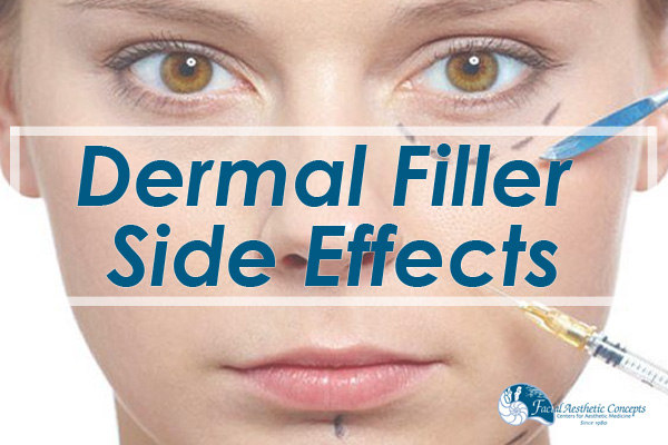 Dermal Filler Side effects