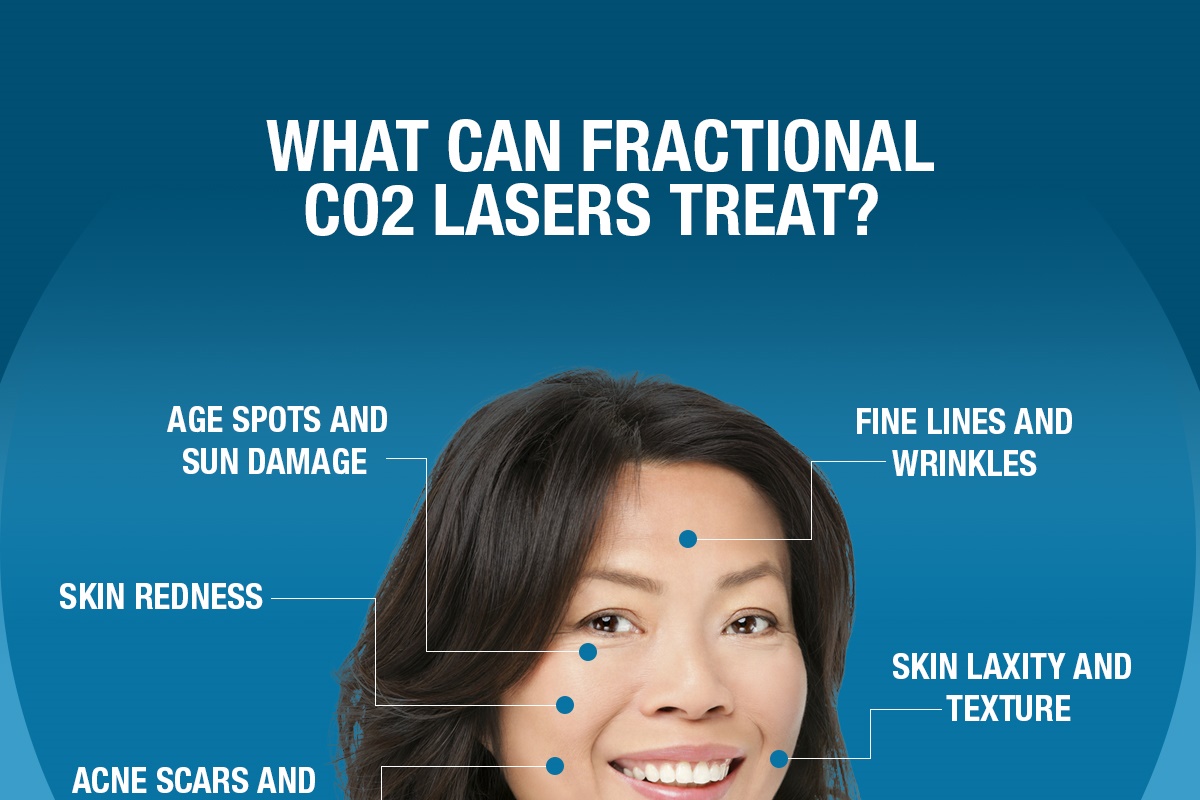 What Can Fractional CO2 Lasers Treat? [Infographic]