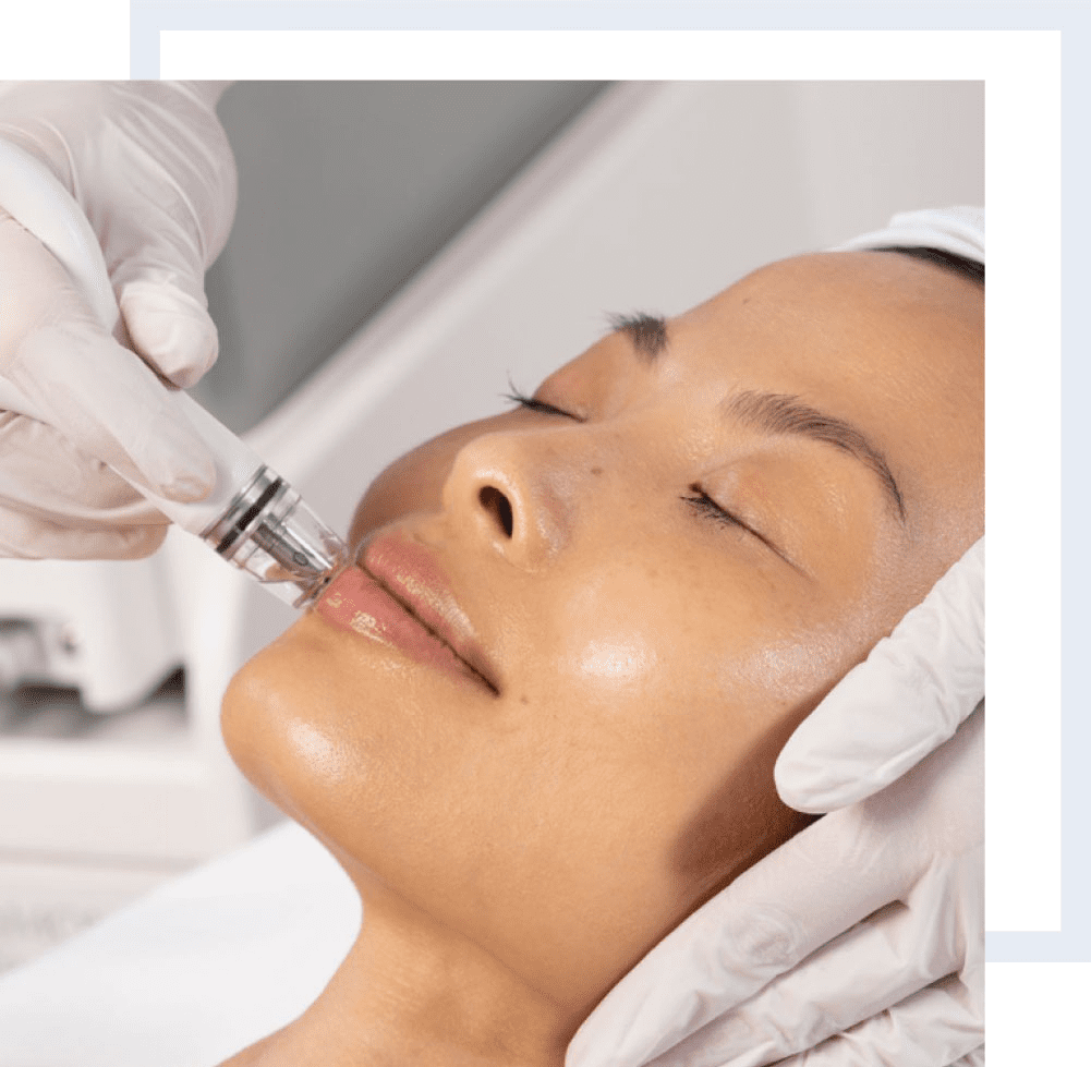 Skin facials in Rancho Santa Margarita